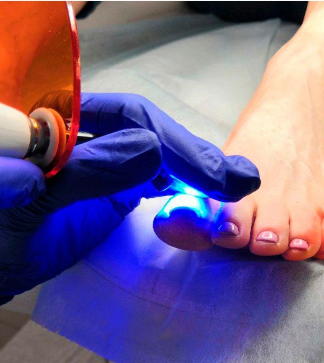 Pedicure Clínico en Cali - Podóloga Karen Cali